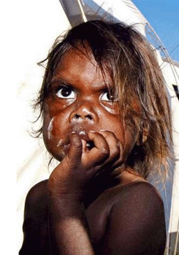 aboriginal-child-maralinga